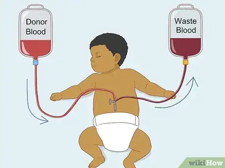 Image titled Fight Jaundice in a Newborn Step 9