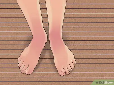 Image titled Shave Your Legs (Male) Step 13