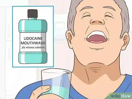 Image titled Prevent a Cold Sore from Forming Step 17