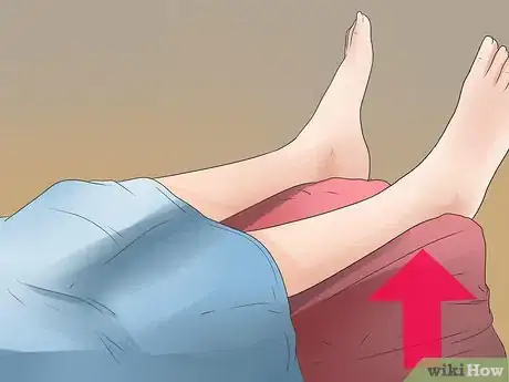 Image titled Get Rid of Gout when Pregnant Step 4