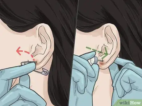 Image titled Pierce Your Ear with a Safety Pin Step 10