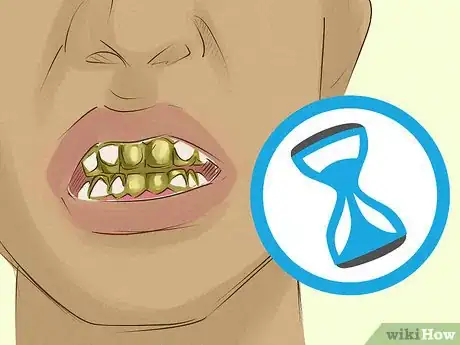 Image titled Clean Gold Teeth Step 11