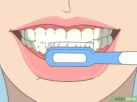 Image titled Fix Nicotine Stained Teeth Step 13