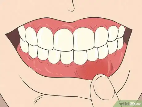 Image titled Fix Nicotine Stained Teeth Step 12