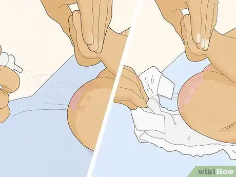 Image titled Use Coconut Oil for Diaper Rash Step 29