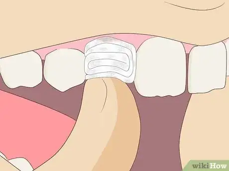 Image titled Pull Out a Tooth Without Pain Step 8