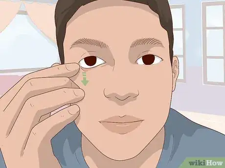 Image titled Clean a Prosthetic Eye Step 5.jpeg