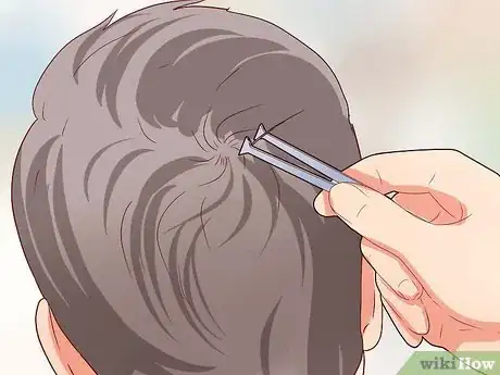 Image titled Measure Hair Loss Step 9