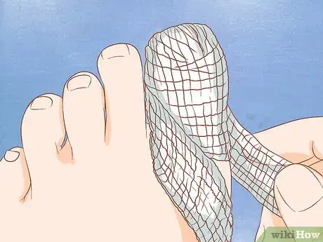 Image titled Help a Toenail Grow Back Quickly Step 2