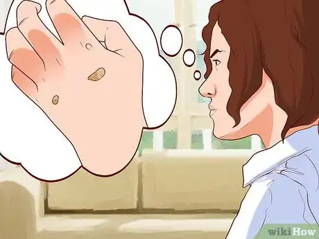 Image titled Remove Warts Naturally Using Garlic Step 18