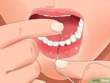 Image titled Get Pink Gums Step 11