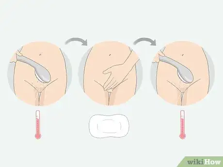 Image titled Get Rid of Ingrown Pubic Hair Step 12