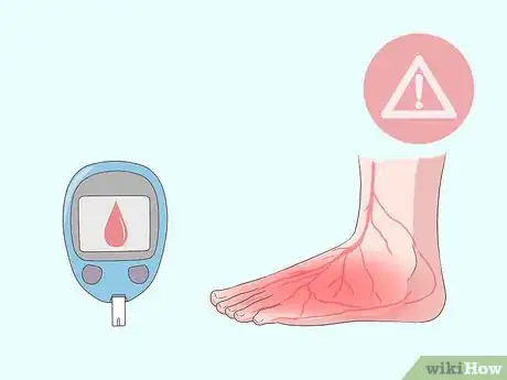 Image titled Relieve Ingrown Toe Nail Pain Step 4