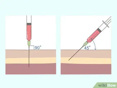 Image titled Give a B12 Injection Step 5