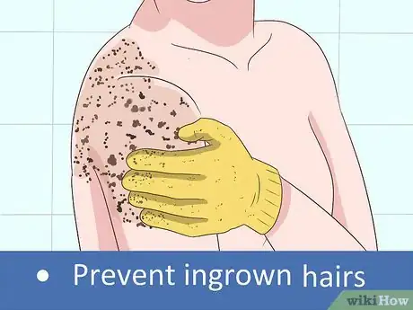 Image titled Remove a Cyst on Your Back Step 18