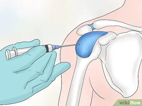 Image titled Treat Shoulder Tendonitis Step 15