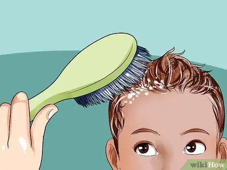 Image titled Easily Clean Baby's Cradle Cap Dandruff Without Hurting the Baby Step 3