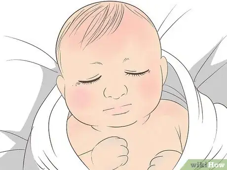 Image titled Know What to Expect on a Newborn's Skin Step 1