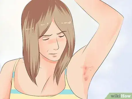 Image titled Keep Your Underarms Fresh and Clean Step 13