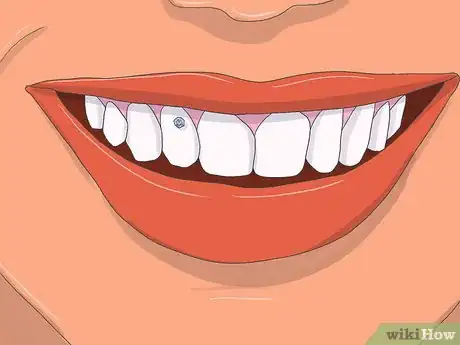 Image titled Apply Tooth Gems Step 14