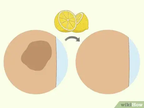 Image titled Use a Lemon to Lighten Your Skin Step 2