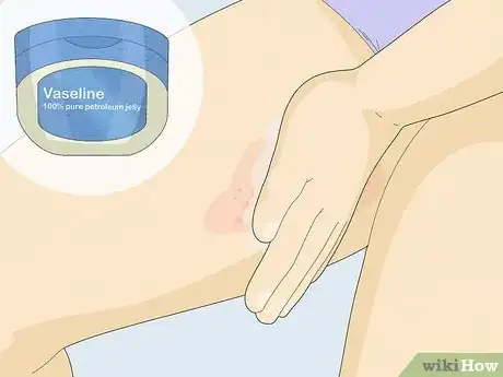 Image titled Prevent Chafing Step 10