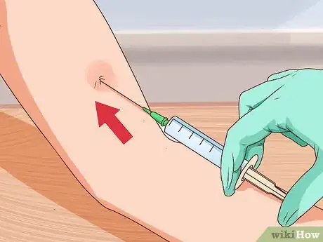 Image titled Recognize Tetanus (Lockjaw) Step 11