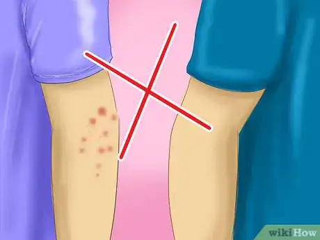 Image titled Avoid Catching Scabies Step 1