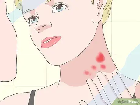 Image titled Treat a Rash on the Neck Step 3