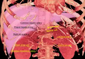 3D-rendered computed tomography, showing splenic artery at upper right.