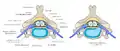 Normal situation and spinal disc herniation in cervical vertebrae