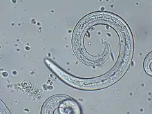 "Angiostrongylus vasorum" (male) from canine blood sample.