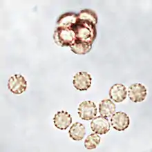 Oblate, light yellow-brown, rough-walled ascospores