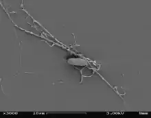 Aplanochytrium sp. under SEM