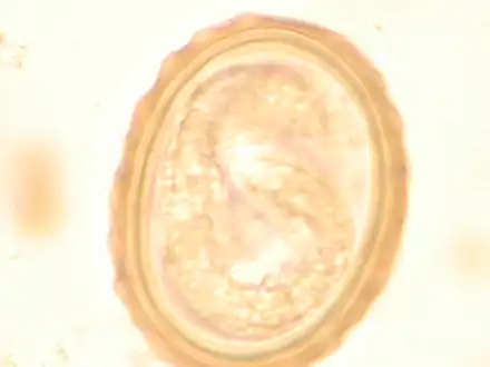 The larva of Ascaris lumbricoides developing in the egg