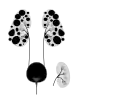 Diagram of autosomal dominant polycystic disease with a normal kidney inset for comparison