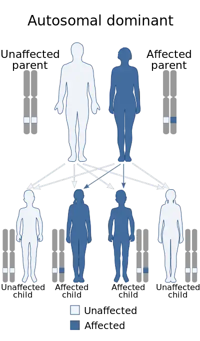 A diagram of the autosomal dominant inheritance pattern, showing how a gene can be passed from an affected parent to an affected child.