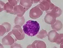 Alternate stain of a basophil