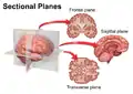 Sectional planes of the brain