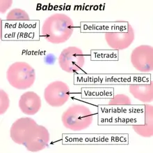 Blood smear of Babesia microti