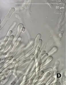 Cystidia-like structures