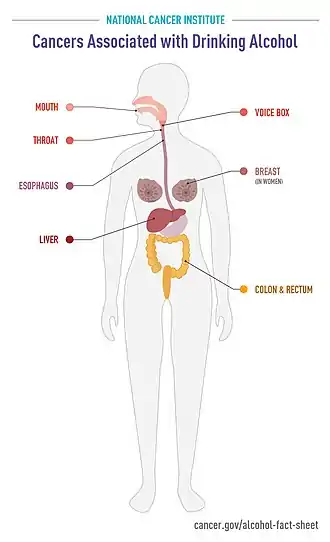 Cancers-associated-with-drinking-alcohol-infographic. It shows breast cancer, colorectal cancer, esophageal cancer, liver cancer, and head-and-neck cancers