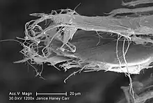 Scanning electron microscopy of white asbesto with needle-like shape fibre