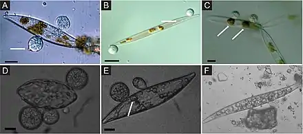 Image 3Chytrid parasites of marine diatoms. (A) Chytrid sporangia on Pleurosigma sp. The white arrow indicates the operculate discharge pore. (B) Rhizoids (white arrow) extending into diatom host. (C) Chlorophyll aggregates localized to infection sites (white arrows). (D and E) Single hosts bearing multiple zoosporangia at different stages of development. The white arrow in panel E highlights branching rhizoids. (F) Endobiotic chytrid-like sporangia within diatom frustule. Bars = 10 μm. (from Marine fungi)