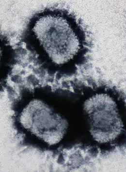 Electron micrograph of three "Cowpox virus" particles