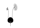 Cystic dysplasia - can affect one or both kidneys