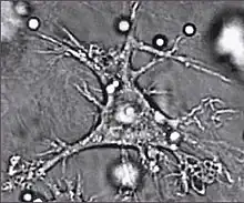 One dendritic cell, which is almost the shape of a star. Its edges are ragged.