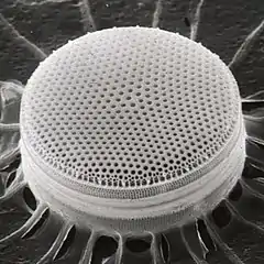 Centric diatom(radial symmetry)