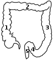 1: Ascending colon2: Transverse colon3: Descending colon4: Sigmoid colon5: Rectum