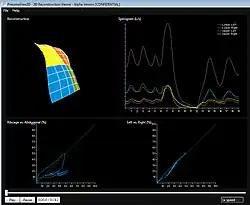 Diseased Patient SLP Scan